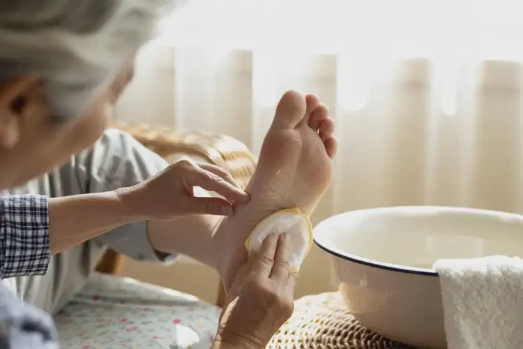 高龄老人脚上容易起湿疹能不能根治(图4)