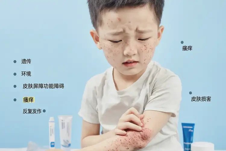 儿童四肢容易起湿疹能够彻底治愈吗(图1)