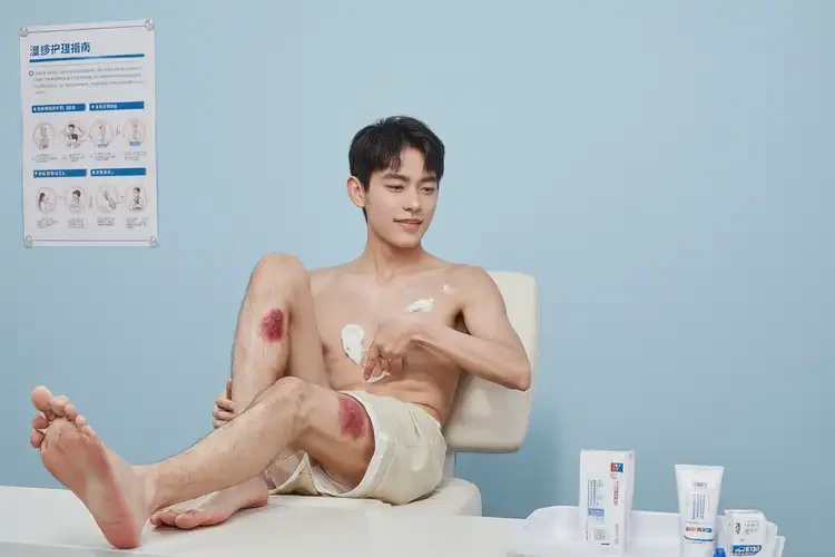 青年人大腿上起濕疹可以徹底自愈嗎(圖3)