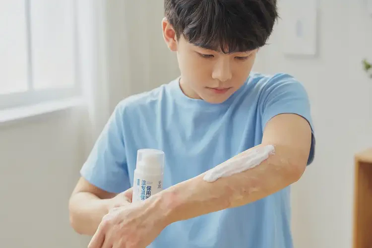 青少年手臂上容易長濕疹不管它會自己好嗎(圖2)