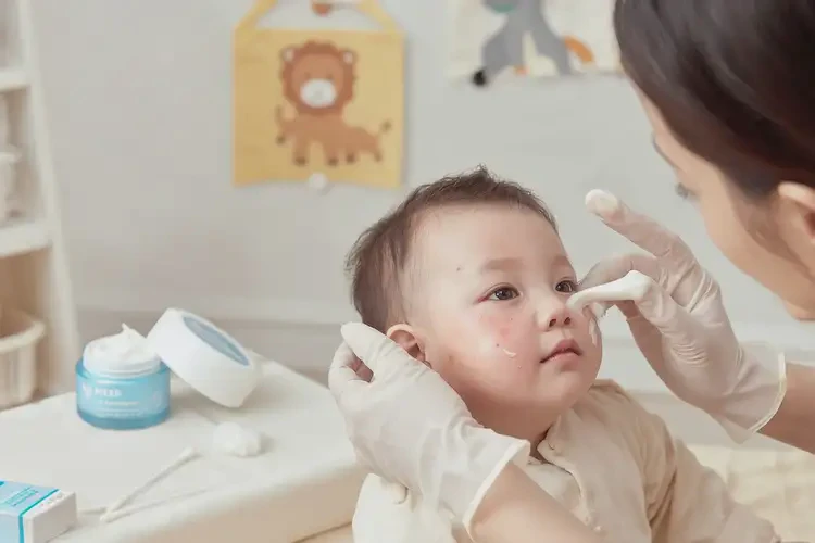 嬰幼兒臉上容易起濕疹能徹底自愈嗎(圖2)