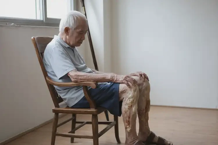 老人小腿有湿疹不管它会自己自愈吗(图1)