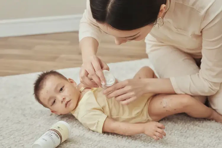 幼兒四肢起濕疹可以徹底自愈嗎(圖3)