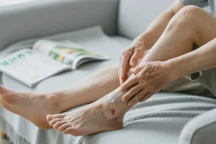 老年人四肢出現(xiàn)濕疹可不可以根治(圖3)