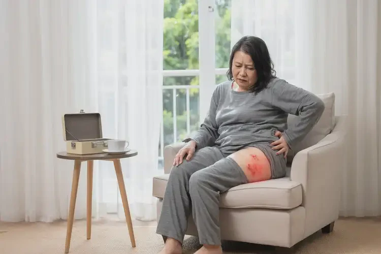 女生屁股上有湿疹不管它会自己自愈吗(图2)