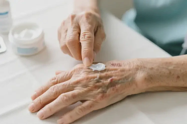 高齡老人手上容易長濕疹能不能根治(圖1)