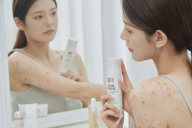 男性全身有濕疹能靠自己自愈嗎(圖4)