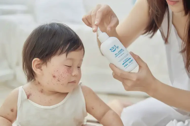 幼儿脖子上出湿疹不管它会自己痊愈吗(图3)