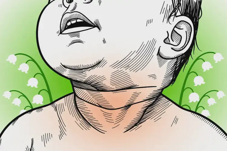 寶寶脖子上容易起濕疹能靠自己自愈嗎(圖2)