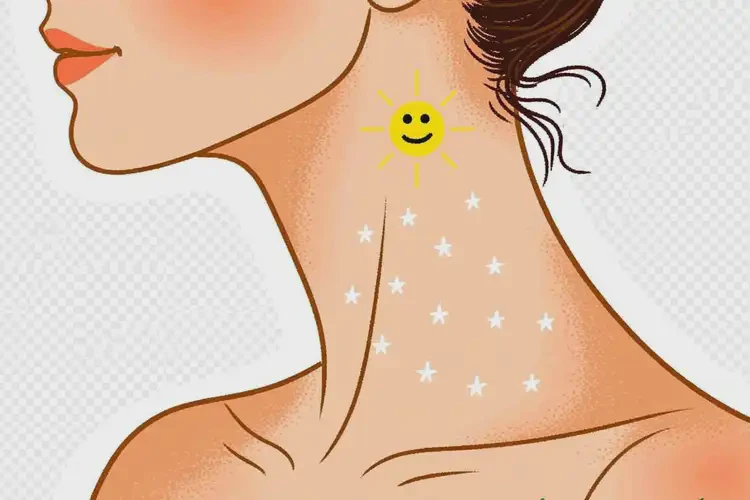 女生脖子上經(jīng)常長濕疹可不可以徹底自愈(圖1)