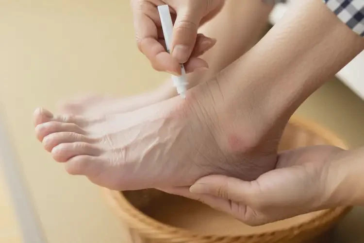 高齡老人腳上偶爾起濕疹可不可以徹底自愈(圖3)