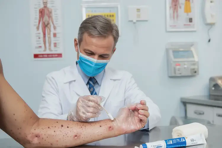 青少年手臂出现湿疹可以彻底自愈吗(图3)