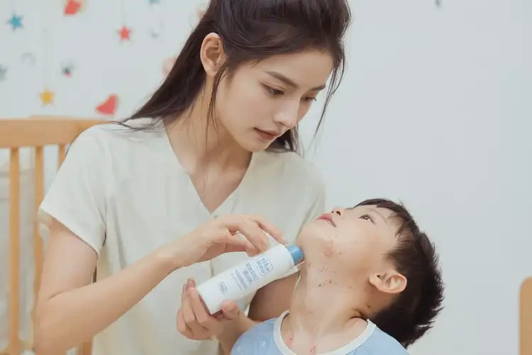 孩子脖子上出湿疹能靠自己自愈吗(图3)
