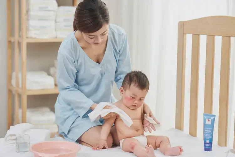 小兒屁股上出濕疹不管它會自己好嗎(圖3)