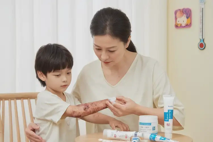 幼兒手臂上有濕疹能靠自己自愈嗎(圖3)