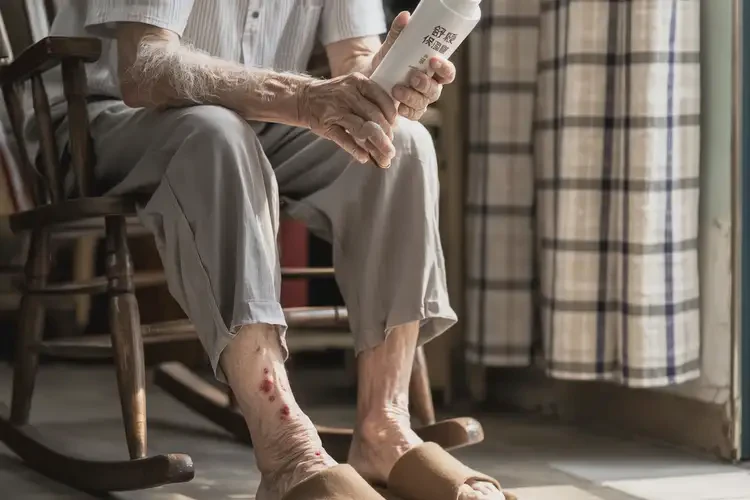 高齡老人腳上起濕疹能夠徹底治愈嗎(圖3)