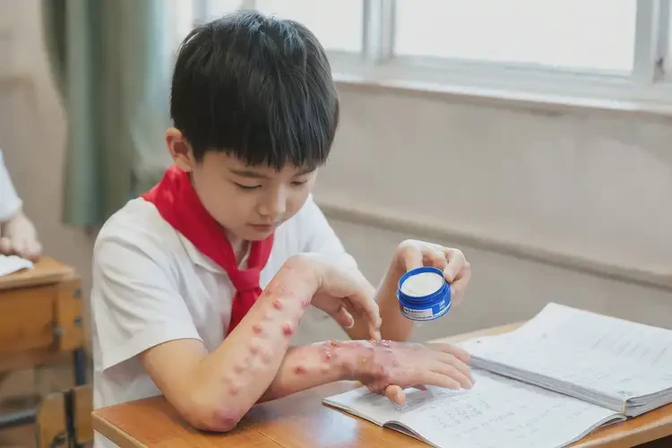 小學(xué)生手上出濕疹能靠自己自愈嗎(圖3)