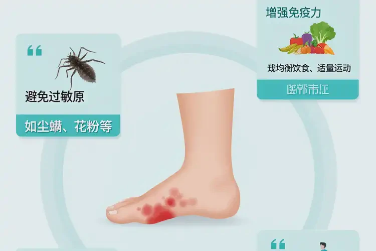 小兒腳上有濕疹不管它會自己好嗎(圖1)