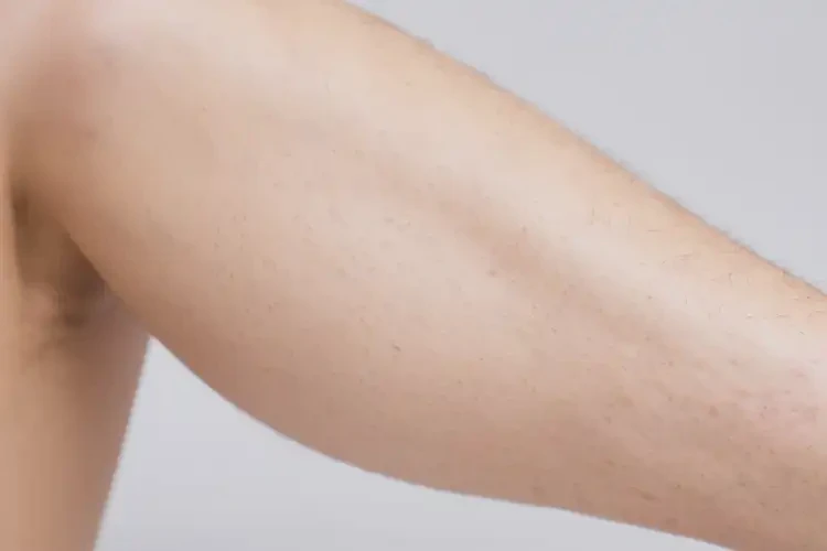 男人小腿上偶尔长湿疹能不能根治(图4)