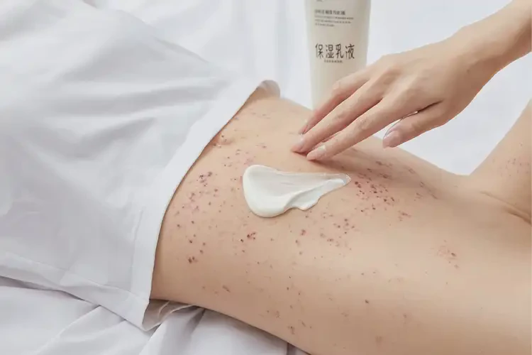 女性肚子上容易起濕疹不管它會(huì)自己好嗎(圖3)