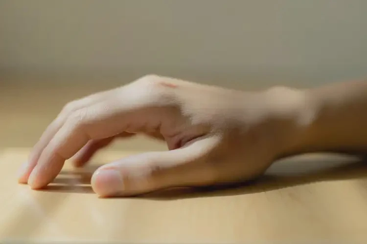 男性手上有濕疹能夠徹底治愈嗎(圖4)