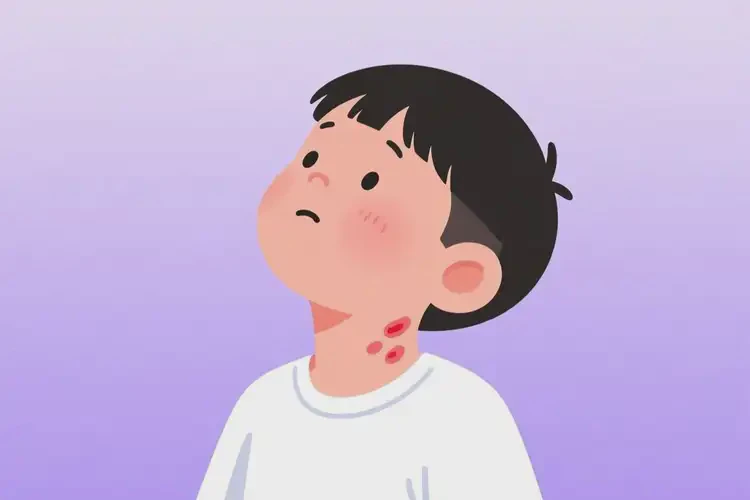 小學(xué)生脖子上偶爾起濕疹不管它會(huì)自己好嗎(圖1)