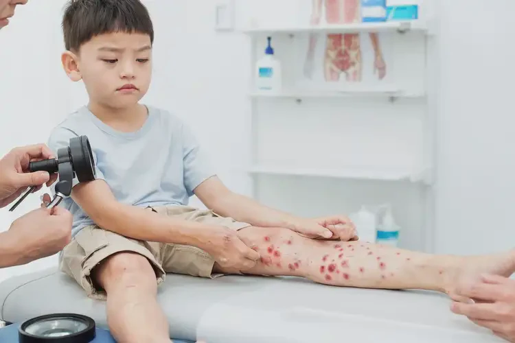 少兒手臂長濕疹不管它會自己好嗎(圖2)