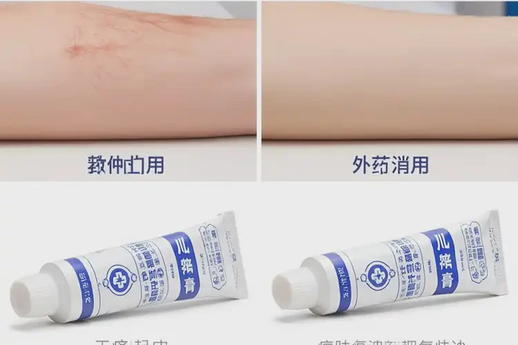 小兒屁股上容易長濕疹能夠徹底治愈嗎(圖2)