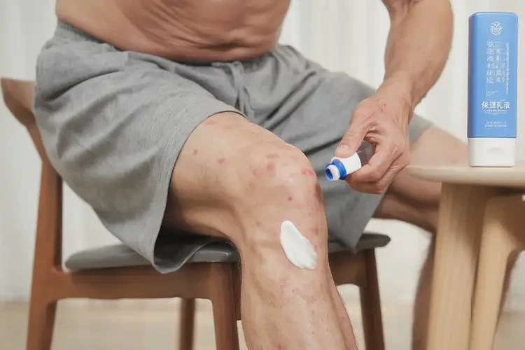 男人大腿有濕疹能不能根治(圖2)