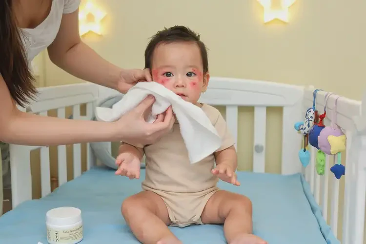 嬰兒全身起濕疹可以徹底自愈嗎(圖3)