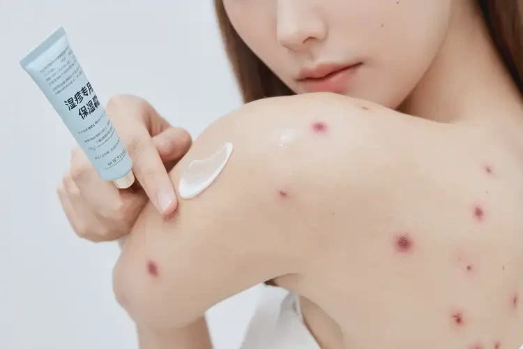 女生手臂上容易長(zhǎng)濕疹能徹底自愈嗎(圖3)