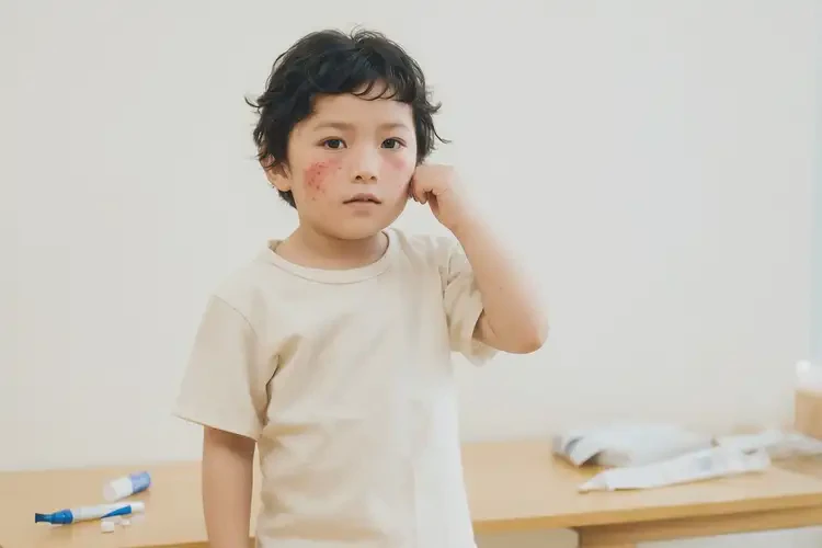 小孩臉上經(jīng)常長濕疹可不可以徹底自愈(圖2)