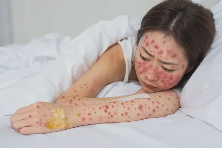 女生屁股上偶爾長(zhǎng)濕疹不管它會(huì)自己好嗎(圖1)