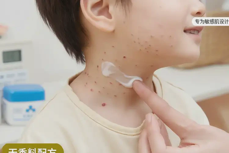 兒童脖子長濕疹能靠自己自愈嗎(圖4)