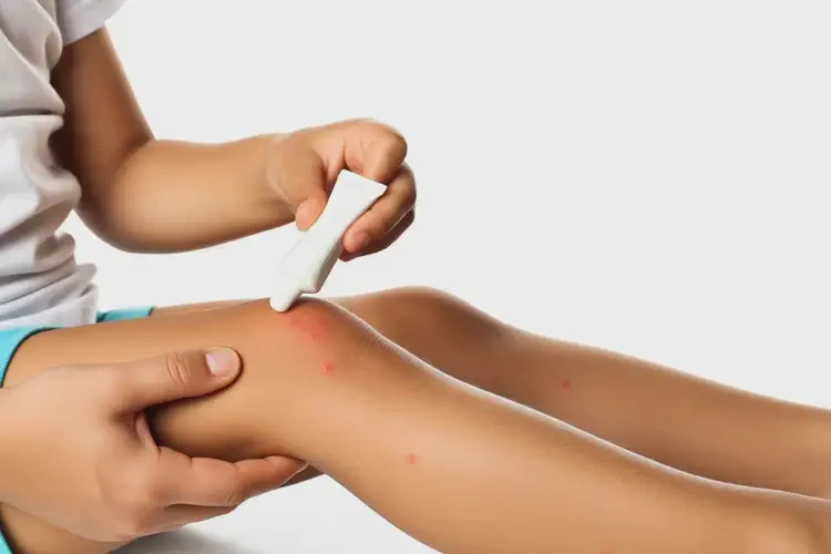 孩子四肢容易起濕疹可不可以根治(圖4)