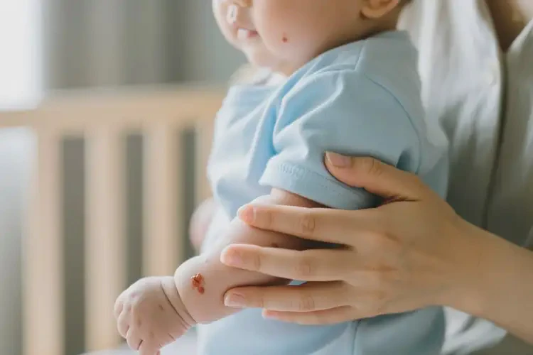 新生兒身上有濕疹不管它會自己自愈嗎(圖2)