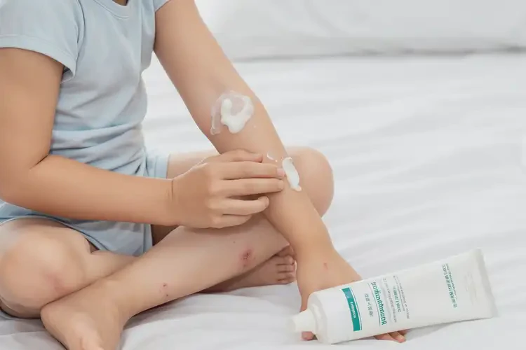 兒童大腿經(jīng)常起濕疹可不可以根治(圖3)