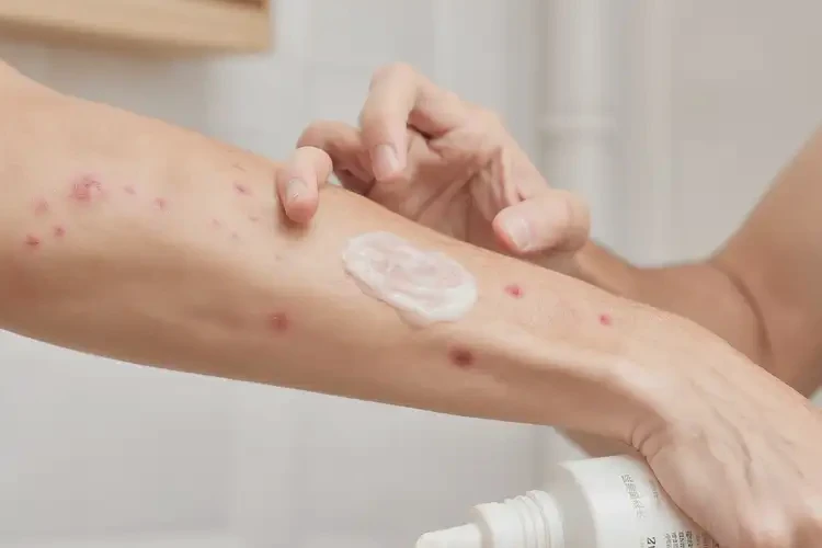 青年人四肢偶爾長濕疹不管它會自己痊愈嗎(圖3)