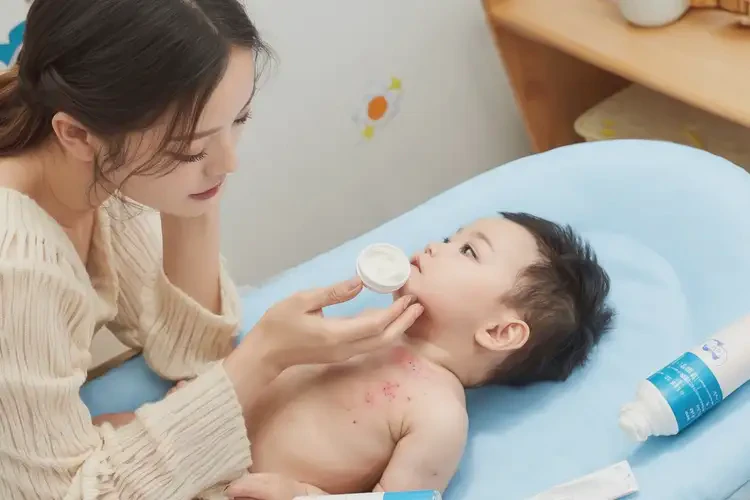 嬰兒脖子出濕疹可不可以根治(圖3)