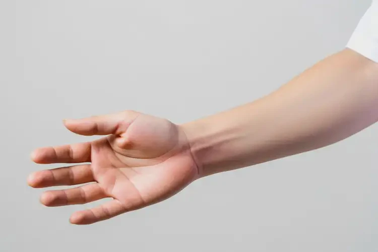 大学生手臂上容易长湿疹可以彻底自愈吗(图4)