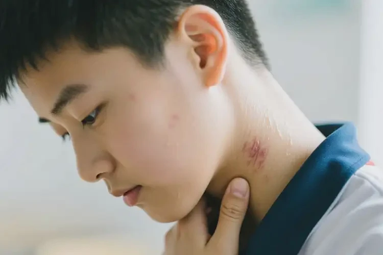 中學(xué)生脖子上容易長濕疹能靠自己自愈嗎(圖3)