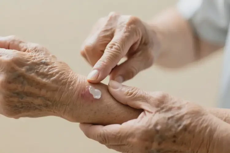 老人手臂偶尔起湿疹可不可以根治(图1)