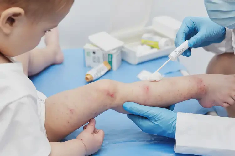 嬰兒手臂上經(jīng)常長濕疹可不可以根治(圖3)