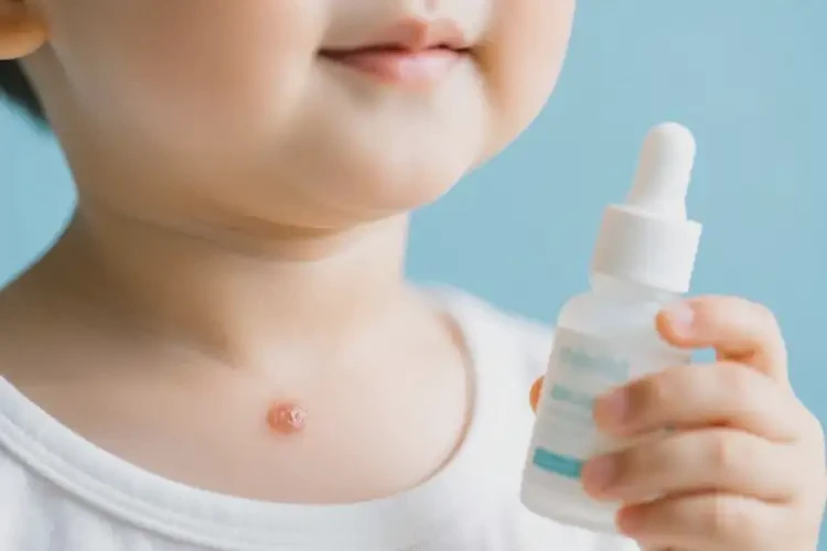 小學生脖子上偶爾長濕疹能徹底自愈嗎(圖1)