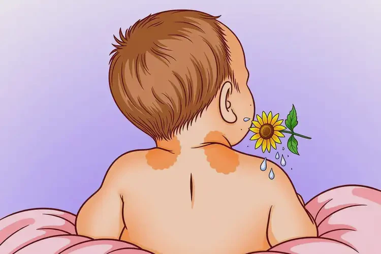 寶寶脖子上容易起濕疹能靠自己自愈嗎(圖1)