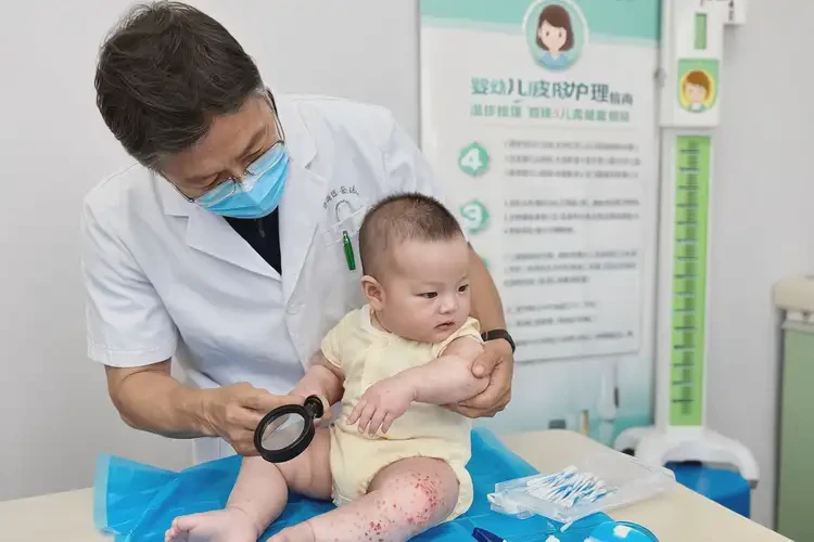 寶寶腳上出濕疹能徹底自愈嗎(圖1)