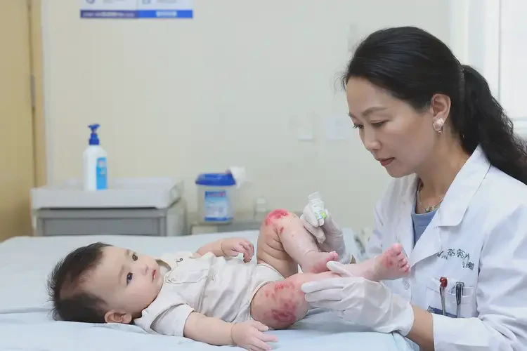 嬰幼兒大腿上偶爾起濕疹可不可以根治(圖3)