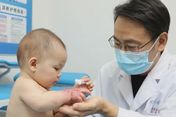 嬰兒手上出濕疹能徹底自愈嗎(圖3)