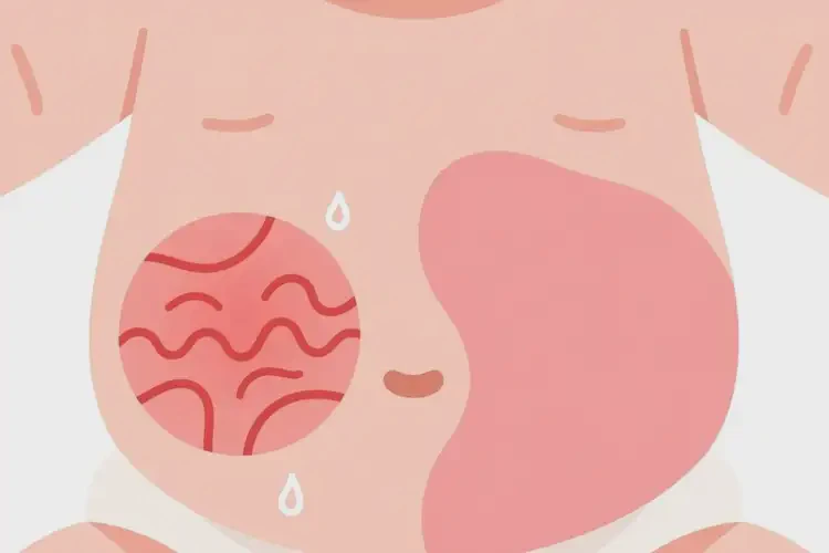 小兒肚子經(jīng)常起濕疹不管它會(huì)自己自愈嗎(圖1)