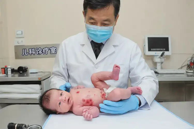 新生兒大腿上容易長濕疹不管它會自己痊愈嗎(圖1)